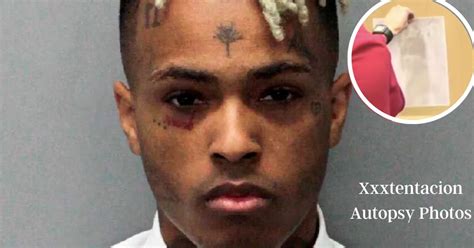 xxxtentaction autopsy photos|Jahseh Onfroy (XXXTentacion) Autopsy Report